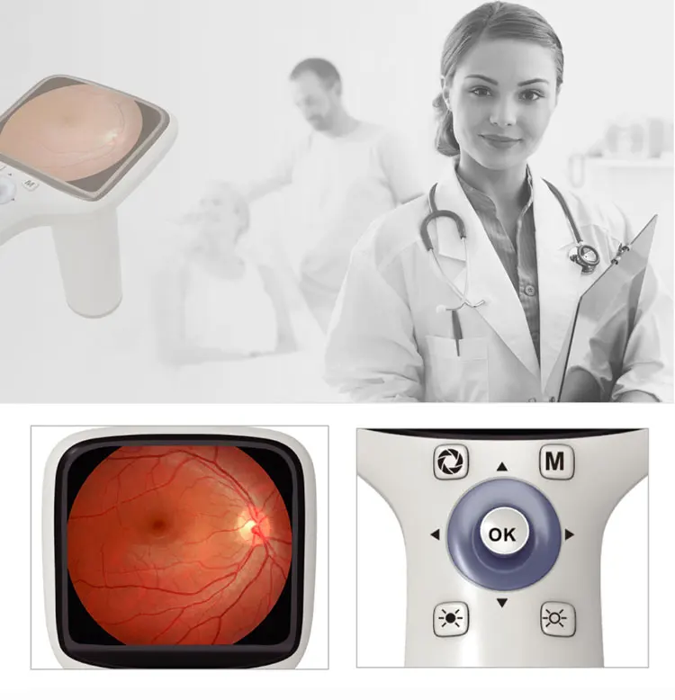 Портативный немидриатический аппарат для офтальмологии Глазное дно Изображение 1
