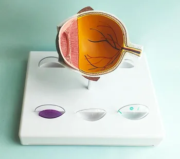 Модель глаза при глаукоме, глазной чип/модель анатомии радужной оболочки, модель строения глаза  2